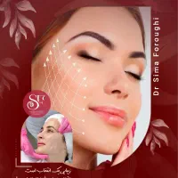 لیفت صورت با نخ (اقساط)