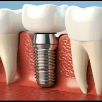 کلینیک دندانپزشکی باارائه تمامی خدمات.
