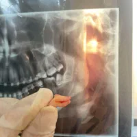 کشیدن با تعرفه خیریه|خدمات آرایشگری و زیبایی|قم, زنبیل آباد|دیوار