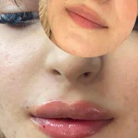 جشنواره حمایتی پوست و مو(لیزر،بوتاکس،رفع تیرگی)