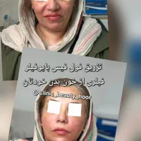 کلینیک زیبایی گلد( فیلر ژل بوتاکس) توسط پزشک|خدمات آرایشگری و زیبایی|سنندج, |دیوار