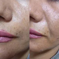 خدمات زیبایی