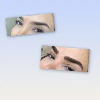 میکروبلیدینگ کرکی مویی