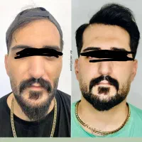 اف ویژه تمام خدمات زیبایی و جراحی در مطب|خدمات آرایشگری و زیبایی|یاسوج, |دیوار