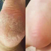 محصولات درمانی با بهترین کیفیت|آرایشی، بهداشتی، درمانی|ارومیه, |دیوار