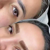 پاک کردن انواع تتو و خالکوبی بالیزر تخصصی کیوسویچ