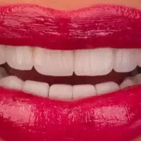 خدمات لابراتوار دندان مصنوعی وعصب کشی