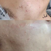 خدمات فیشیال تخصصی