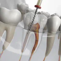 سلامت دندان طراحی خط لبخند آزاداقساطی بیمه تکمیلی