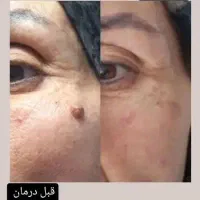 محلول پاک کننده سه روزه