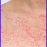 مشاوره تخصصی ویروسهای خاص بدن (مشاوره محرمانه)|آرایشی، بهداشتی، درمانی|گنبد کاووس, |دیوار