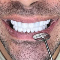 اموزش کامپوزیت ۱۰ میلیون|خدمات آموزشی|تهران, ترمینال غرب|دیوار