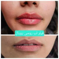 کلینیک رویال دورود|خدمات آرایشگری و زیبایی|دورود, |دیوار