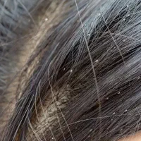 پاکسازی شپش،رشک، با دستگاه و محلول صددرصد تضمینی
