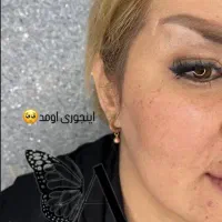 چال گونه/میکرودرمال/پیرسینگ/کاشت نگین کل نقاط بدن