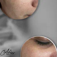 فیشال تخصصی و درمانی صورت|خدمات آرایشگری و زیبایی|شیراز, شهرک والفجر|دیوار