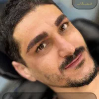 میکروبلیدینگ آقایان شیدینگ لب آقایان اسکالپ سر