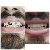 اورژانس دندانپزشکی در منزل شما