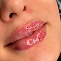 تزریق فیلر بادی بدن۱۲۰هزار|خدمات آرایشگری و زیبایی|جوانرود, |دیوار