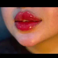 فول فیس پرسینگ چالگونه ژل گونه چونه لب فیلر ژل