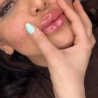 ژل بوتاکس لیفت نخ