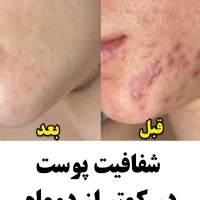 بهبود کبدچرب و معده از نمایندگی