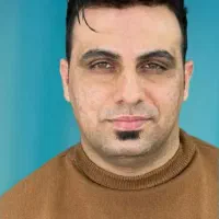 کاشت مو،ابرو،ریش|خدمات آرایشگری و زیبایی|بیرجند, |دیوار