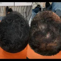 تخفیف 80درصدی پی ار پی فقط1 روز در هفته
