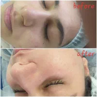 عیدانه فیشیال