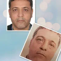 تنهامرکزلیفت صورت،بابیشترین تعدادنخاردارونخبدونخار