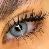 مرکز تخصصی لنز طبی و رنگی