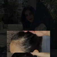 پیازچه موهاتو  تقویت کن