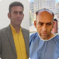 کاشت مو fueپلاس|خدمات آرایشگری و زیبایی|شیراز, قصرالدشت|دیوار