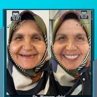 ایمپلنت دندان پزشکی تعرفه دولتی دندانپزشکی تضمینی|خدمات آرایشگری و زیبایی|شیراز, معالی‌آباد|دیوار