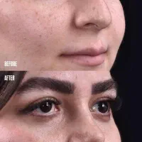 جراحی بدون نقص و متفاوت
