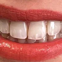 استخدام دستیار دندانپزشکی