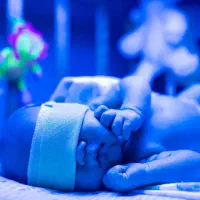 اجاره دستگاه فتوتراپی دستگاه درمان زردی