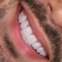 لابراتوار دندانسازی