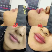 جشنواره کلینیک زیبایی دکتر فهیمه اربابی|خدمات آرایشگری و زیبایی|زابل, |دیوار