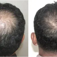 این اخرین اقدامه