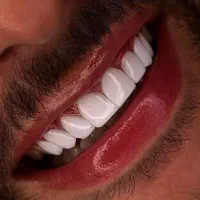 کامپوزیت ویژه آف 40٪ با ضمانت‌نامه