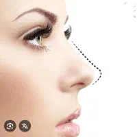 جراحی زیبایی بینی با پزشکان انتخابی شما