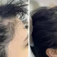 به هرجا بزنی این روغن رو، مو درمیاره اونجا