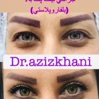 جشنواره تابستانی ۵۰٪ بلفارو پلاستی .تیپ پلاستی|خدمات آرایشگری و زیبایی|تهران, مهران|دیوار