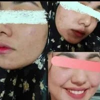 کرم معجزه اصل با کیفیت|آرایشی، بهداشتی، درمانی|تربت‌حیدریه, کلاته توکلی|دیوار