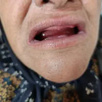 دندانسازی . دندان مصنوعی|خدمات آرایشگری و زیبایی|شیراز, سینما سعدی|دیوار