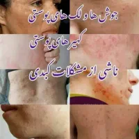 درمان‌بیماری‌ودرمان‌کبدچرب‌بامعجزه‌روغن‌ ها|خوردنی و آشامیدنی|اصفهان, ملک‌شهر|دیوار