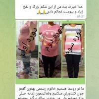 لاغری،اصلاح مزاج،پاکسازی کبد|آرایشی، بهداشتی، درمانی|بیرجند, |دیوار