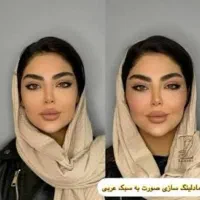 تزریق ژل.بوتاکس.جوانساز