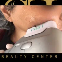 تزریقات زیبایی ژل،بوتاکس،هایفوتراپی،مزوتراپی وفیلر|خدمات آرایشگری و زیبایی|تهران, جنت‌آباد جنوبی|دیوار